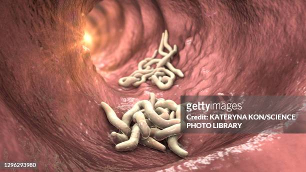 ilustrações, clipart, desenhos animados e ícones de round worms in human intestine, illustration - sistema digestivo animal