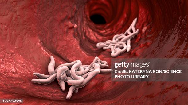 Images Of Pinworms Photos and Premium High Res Pictures - Getty Images