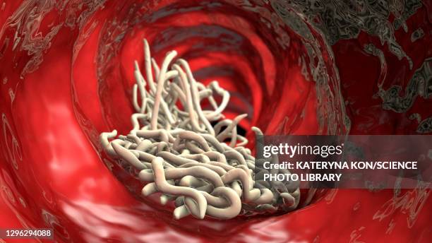 round worms in human intestine, illustration - roundworm stock-grafiken, -clipart, -cartoons und -symbole