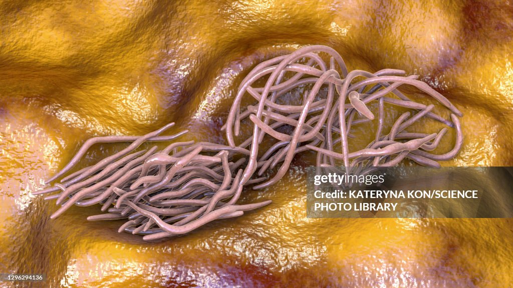 Roundworms Graphics Round Worms Illustration High-Res Vector Graphic - Getty Images