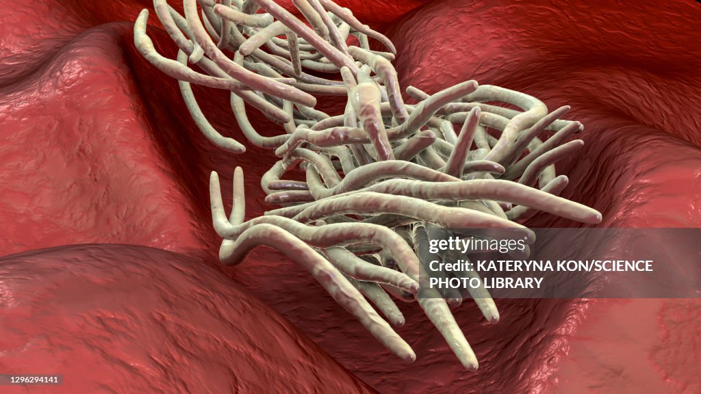 Roundworms Graphics Round Worms Illustration High-Res Vector Graphic - Getty Images