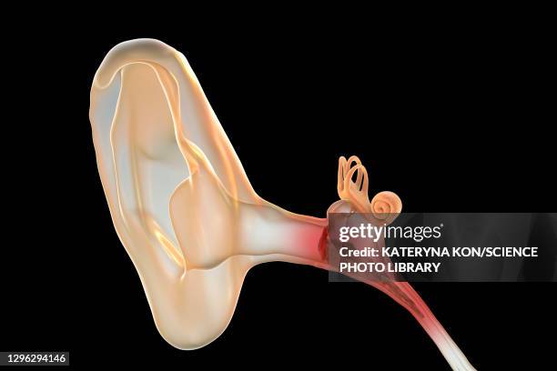 otitis media ear infection, illustration - ohrenschmerzen stock-grafiken, -clipart, -cartoons und -symbole