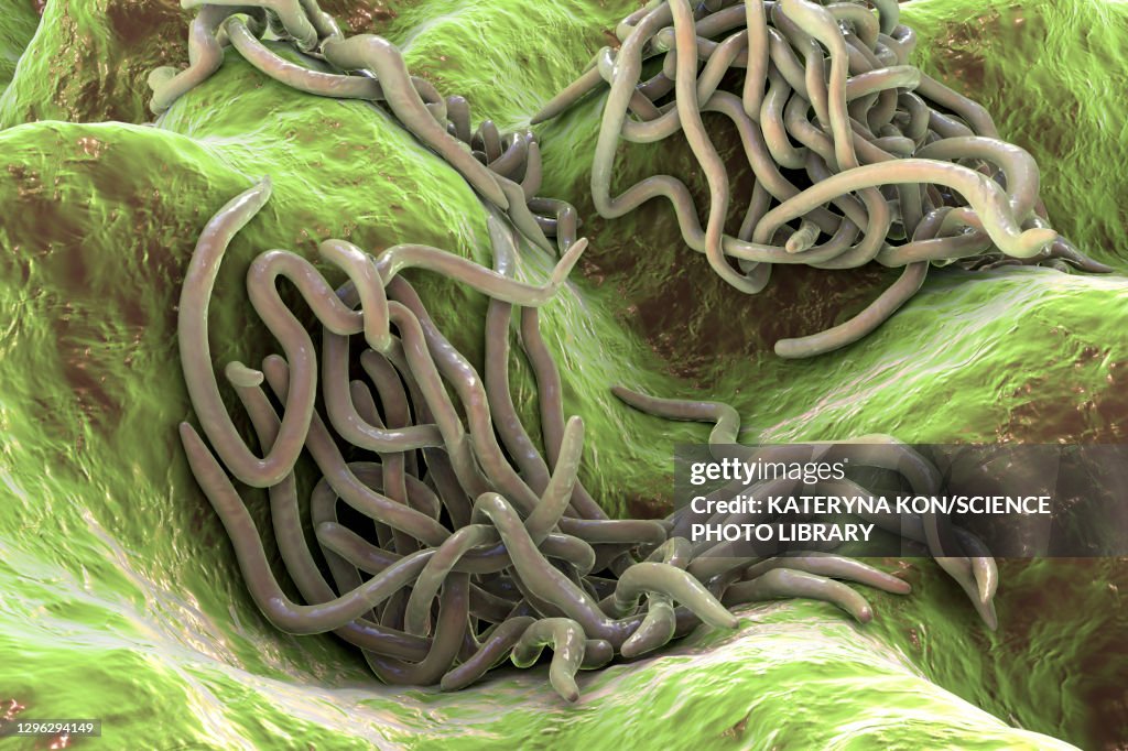 Roundworms Graphics Round Worms Illustration High-Res Vector Graphic - Getty Images