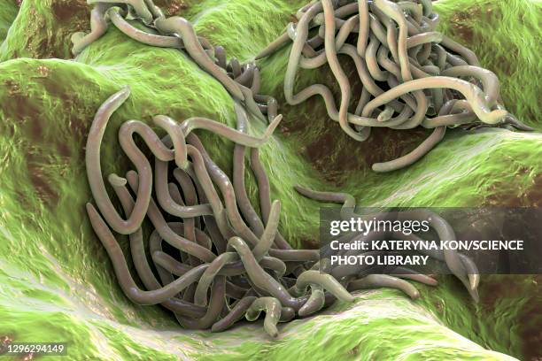 Pin Worms Examples 156 Images Of Pinworms Stock Photos, High-Res Pictures, and Images ...