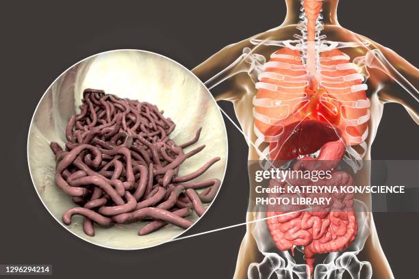 Pinworms Images Photos and Premium High Res Pictures - Getty Images