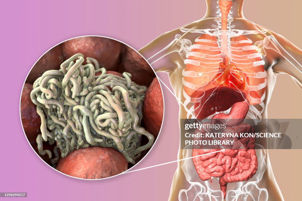 Round worms in human intestine, illustration