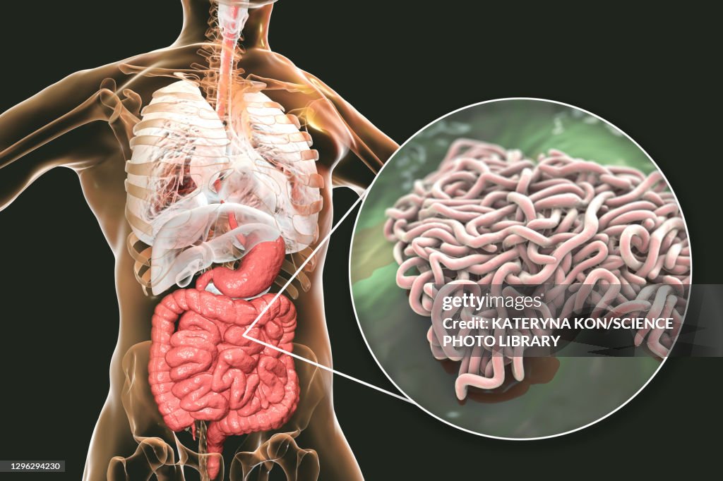 Round worms in human intestine, illustration