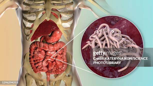 round worms in human intestine, illustration - plattwurm stock-grafiken, -clipart, -cartoons und -symbole