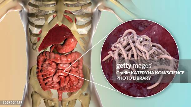 ilustraciones, imágenes clip art, dibujos animados e iconos de stock de round worms in human intestine, illustration - tapeworm