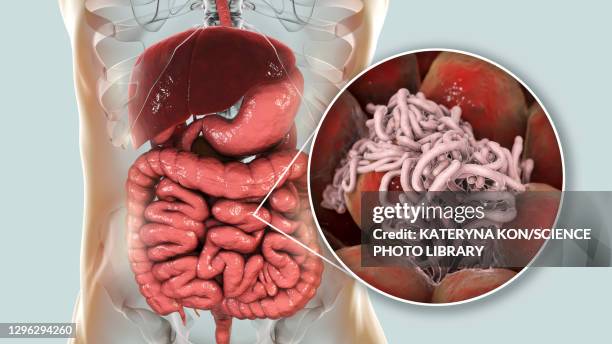 illustrazioni stock, clip art, cartoni animati e icone di tendenza di round worms in human intestine, illustration - tenia