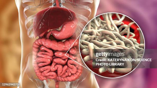 156 Images Of Pinworms Stock Photos, High-Res Pictures, and Images ...