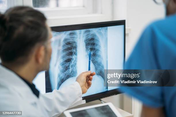 primer plano de los médicos que analizan la película radiológica de rayos x del tórax - rayos x fotografías e imágenes de stock