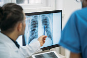 Close up of doctors analysing radiological chest x-ray film