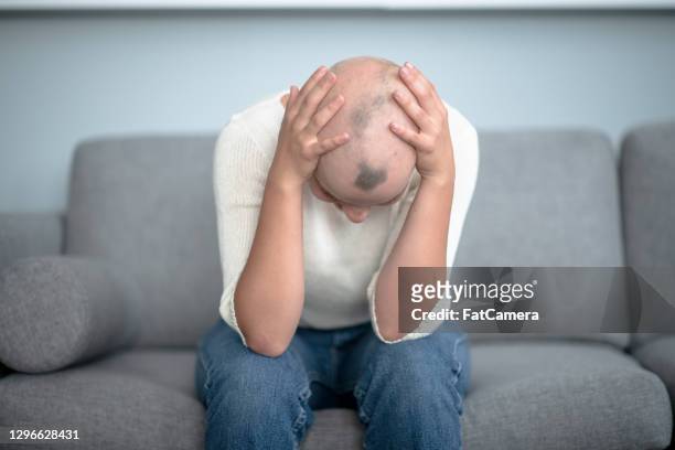 frustrierte junge frau mit alopezie - haarausfall stock-fotos und bilder