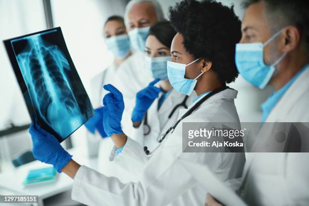 team of doctors analyzing an x-ray image of a covid-19 patient. - human lung stock pictures, royalty-free photos & images