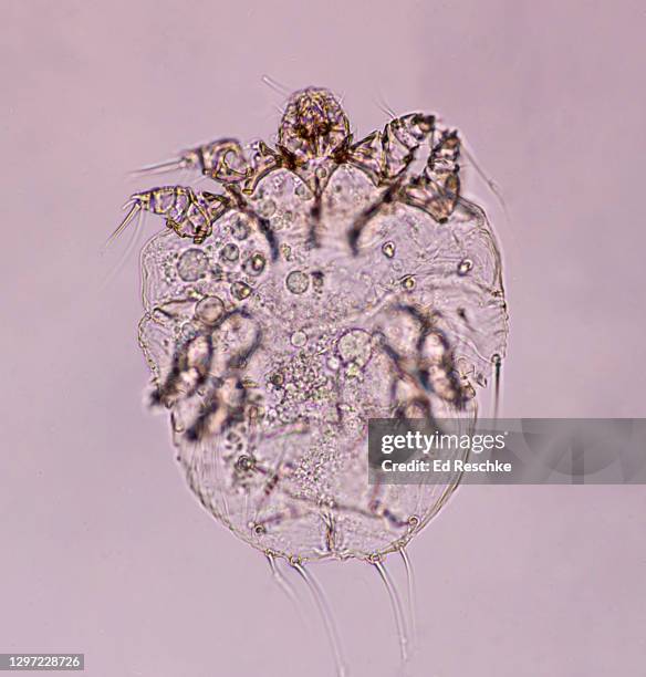 itch mite (sarcoptes scabiel hominis) of humans, causes scabies of the skin or itch, infectious, 50x - mite stock pictures, royalty-free photos & images