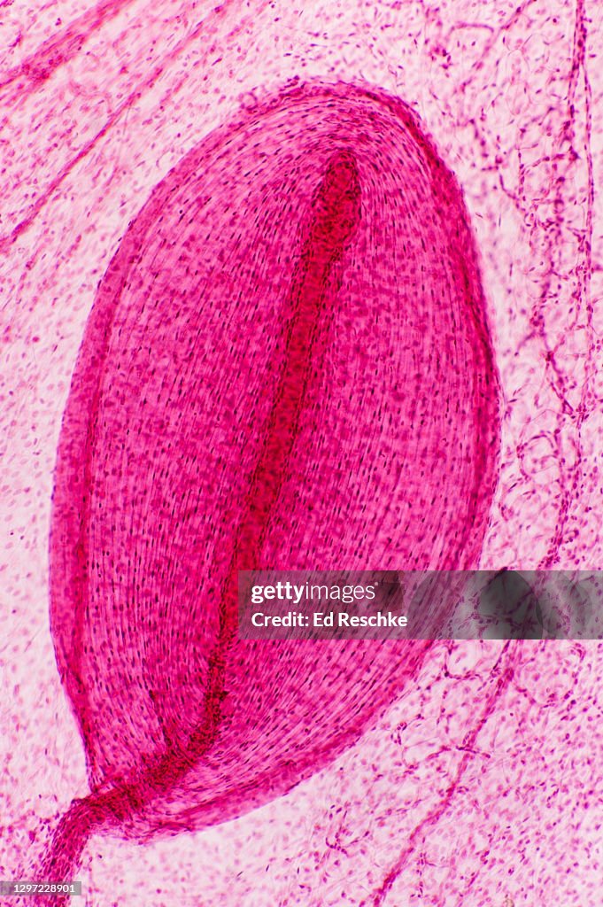 PACINIAN CORPUSCLE---A PRESSURE SENSORY RECEPTOR that is STIMULATED by HEAVY PRESSURE, 25X