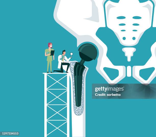 ilustrações, clipart, desenhos animados e ícones de estrutura da articulação artificial do quadril - bacia artificial