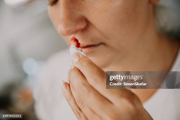 frau blutet aus ihrer nase - menschliche nase stock-fotos und bilder