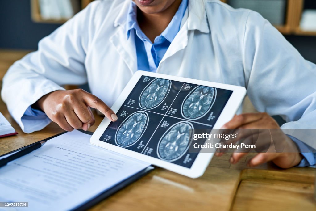 Dit is waar de neurochirurg het overneemt.