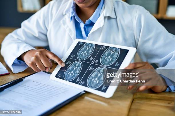 this is where the neurosurgeon takes over - cancer illness stock pictures, royalty-free photos & images