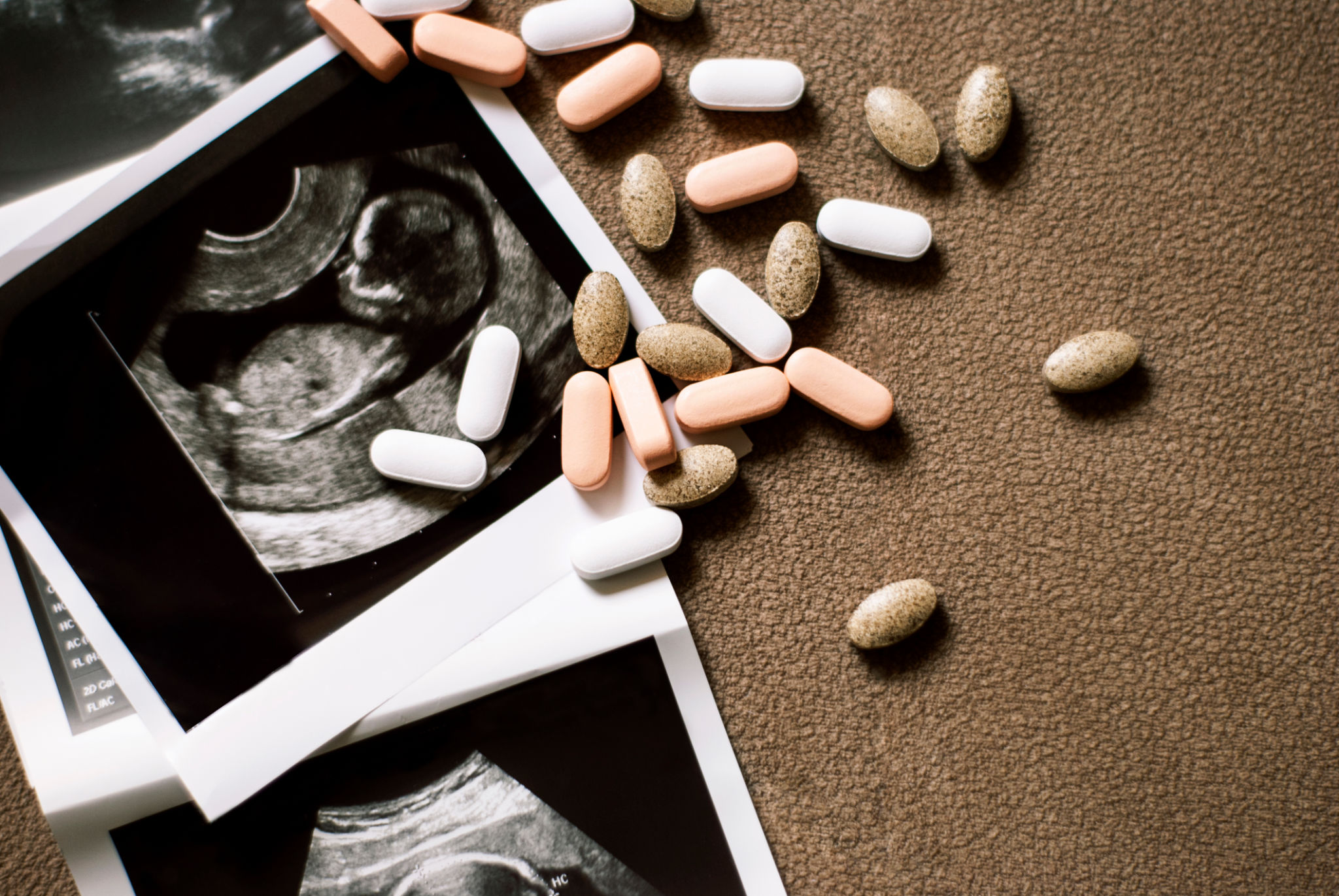 fertility treatment