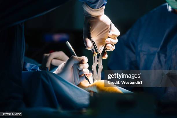 male orthopedic surgeons using medical equipment for ankle surgery in operating room - orthopedic surgeon ストックフォトと画像