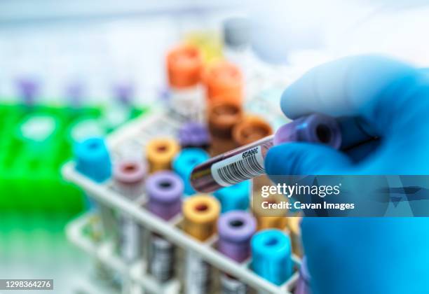 Lab Sample Collection Stock-Fotos und Bilder - Getty Images