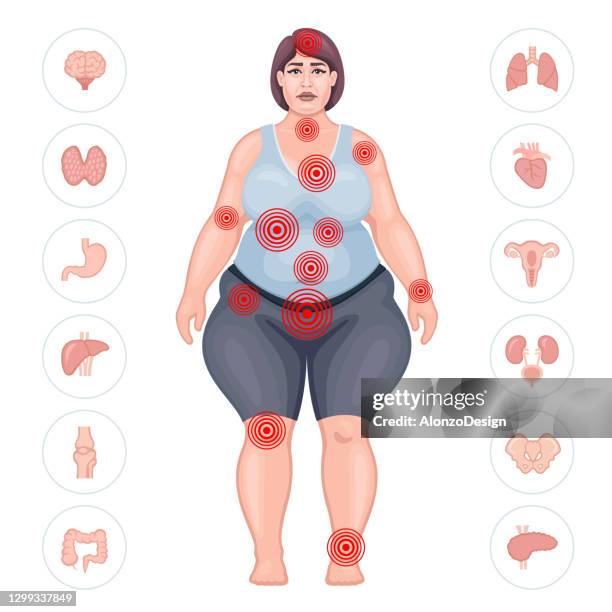 太った女性は、異なる体の部分で痛みに苦しんでいます。ペインマップ。 - adipose cell点のイラスト素材／クリップアート素材／マンガ素材／アイコン素材