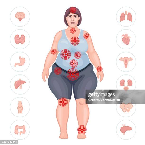 fat woman suffering pain in different body parts. pain map. - neck muscle pain illustration stock illustrations
