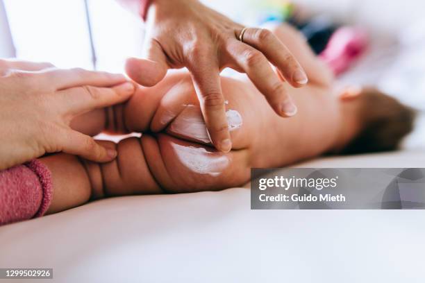 mother applying sore cream on baby girls cheek while changing diaper. - nappy change stock pictures, royalty-free photos & images