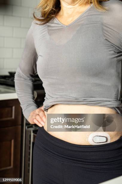 continuous glucose monitor in woman's abdomen - insulin pump stock pictures, royalty-free photos & images