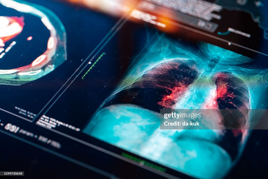 Medische MRI-scan