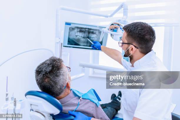 dentist explaining tooth x-rays to a male patient - implante dentário imagens e fotografias de stock