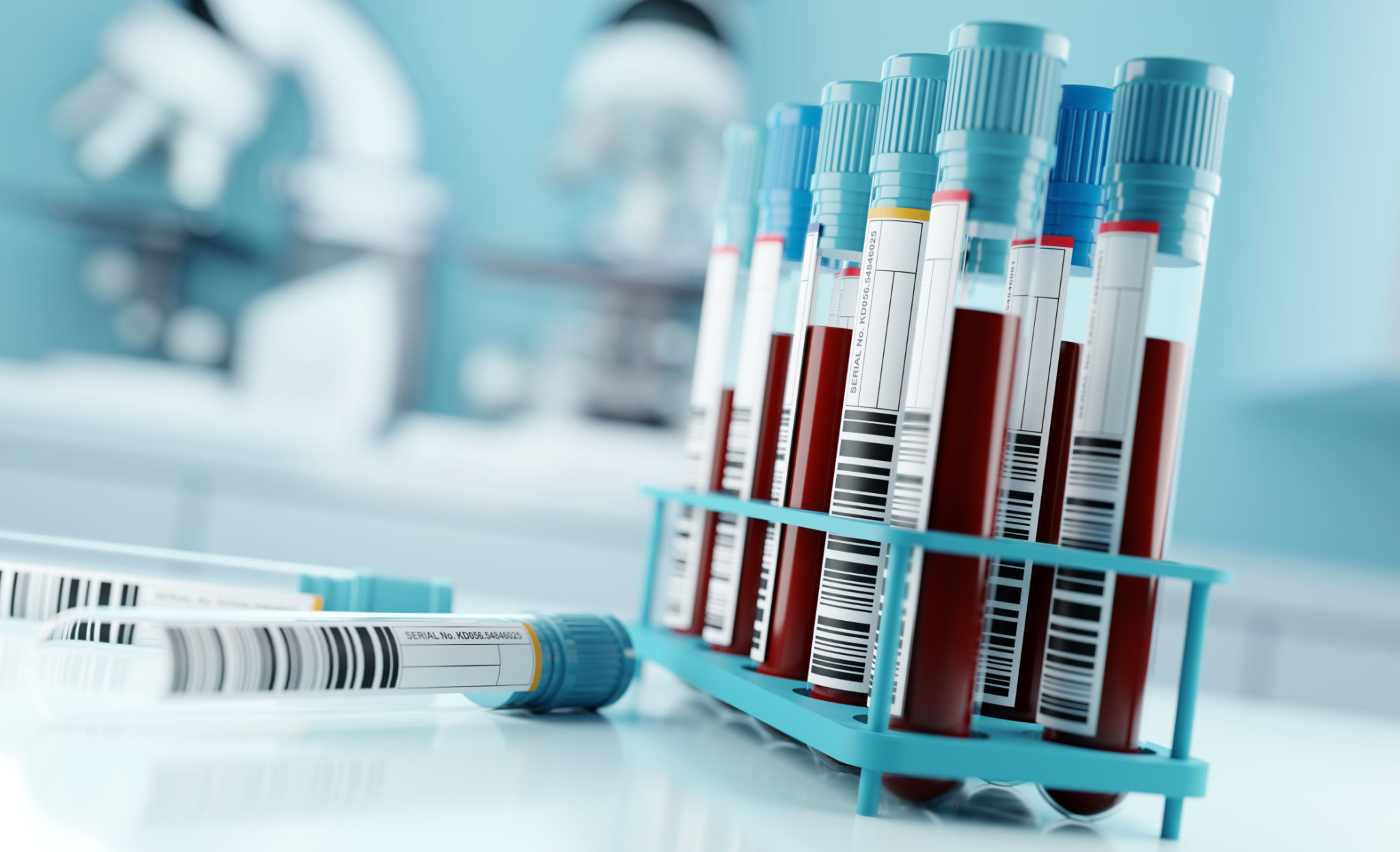 blood test analysis