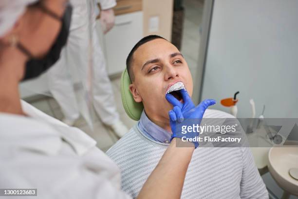 female dentist taking patients dental impression, so she can use that as anatomical model for a ceramic crown - crown moulding stock pictures, royalty-free photos & images
