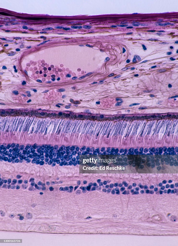 RETINA, ANATOMY--LAYERS and PHOTORECETORS (RODS AND CONES), 100X