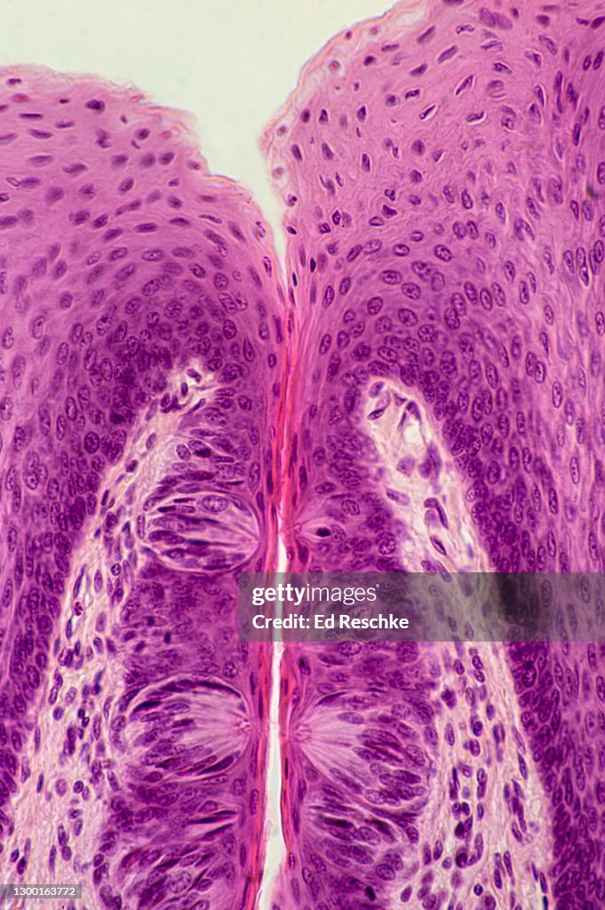 TASTE BUDS--Contain TASTE RECEPTORS (SENSORY RECEPTORS or Chemoreceptors), TONGUE, 100X