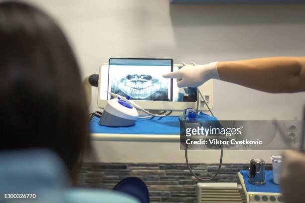 dental radiogram on screen - human jaw bone stock pictures, royalty-free photos & images