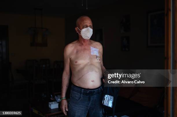 Pancreatic cancer patient Juan Lopez poses in his home with a Covid-19 protective mask and a bag injecting chemotherapy medication into his aortic...