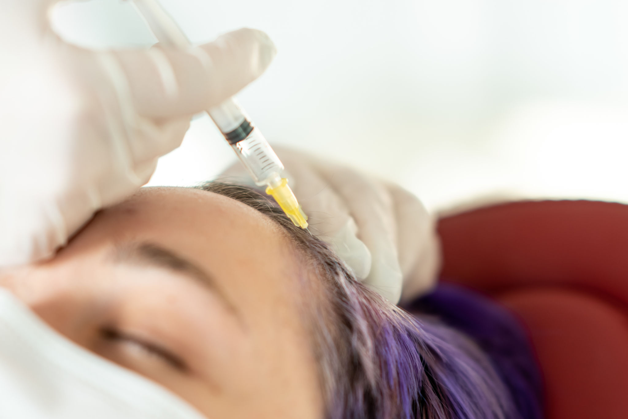 Prp for hair loss minoxidil leicester Prp for hair loss minoxidil leicester
