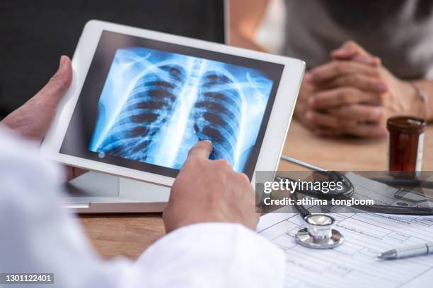 doctor reading the scan lung on digital tablet screen. - rayos x fotografías e imágenes de stock
