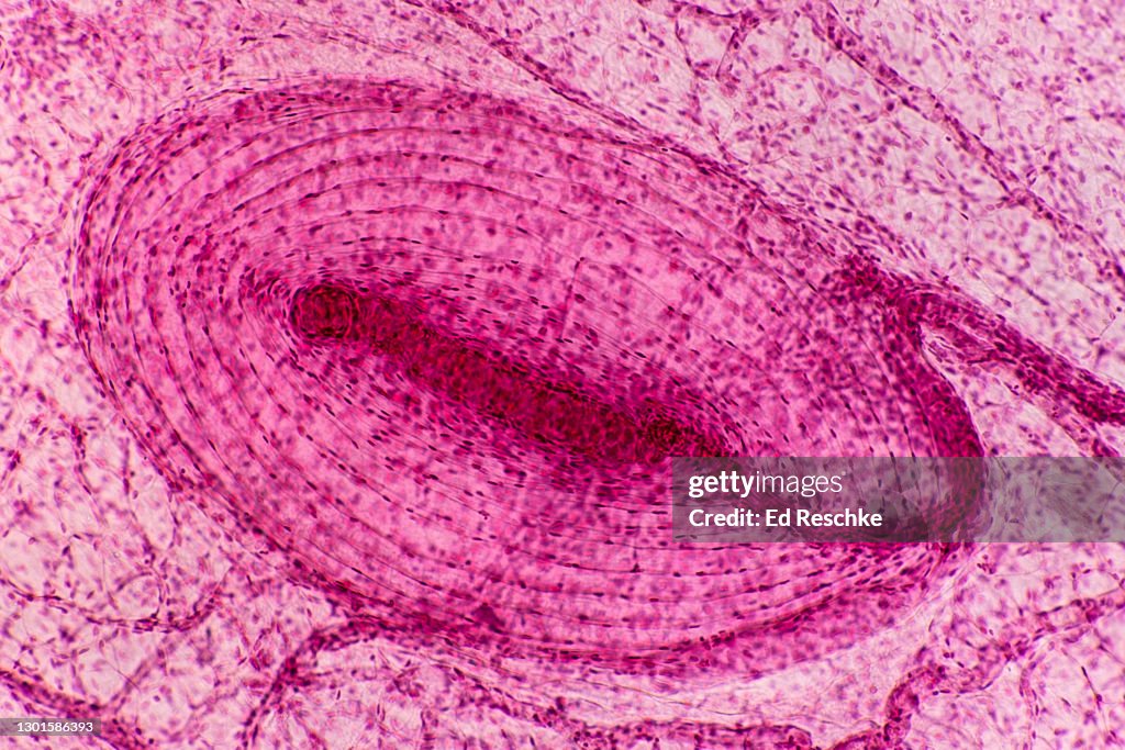 PACINIAN CORPUSCLE--a PRESSURE SENSORY RECEPTOR STIMULATED BY HEAVY PRESSURE, 25X