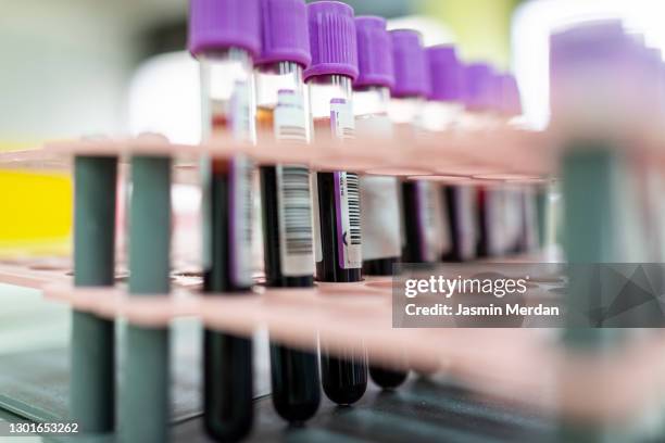 laboratory result with blood tubes - bluttest stock-fotos und bilder