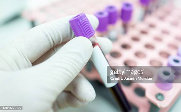 laboratory result with blood tubes - blood tubes stock-fotos und bilder
