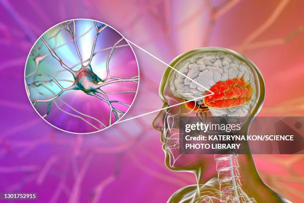 human temporal lobe and neurons, illustration - temporal lobe stock-grafiken, -clipart, -cartoons und -symbole