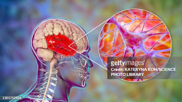 human temporal lobe and neurons, illustration - temporal lobe stock-grafiken, -clipart, -cartoons und -symbole