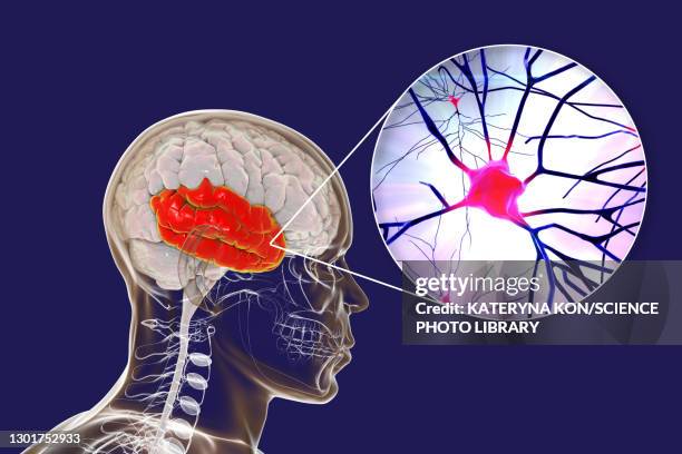 human temporal lobe and neurons, illustration - temporal lobe stock-grafiken, -clipart, -cartoons und -symbole