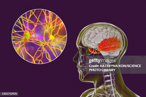 human temporal lobe and neurons, illustration - temporal lobe stock-grafiken, -clipart, -cartoons und -symbole