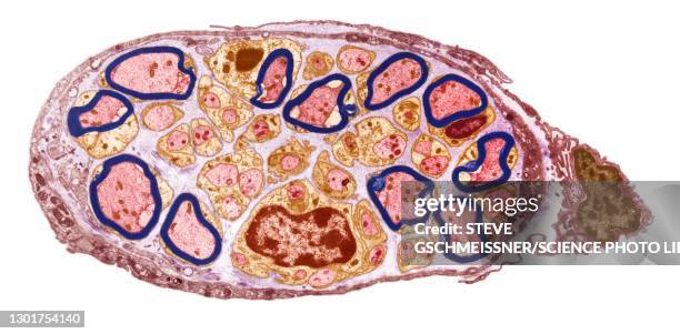 peripheral nerve, tem - endoneurium stock pictures, royalty-free photos & images